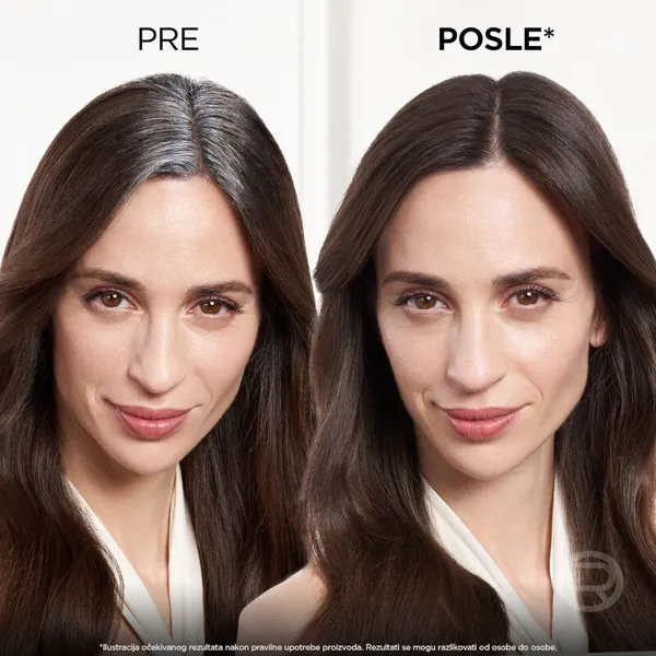 Farba za kosu LOREAL PARIS L'Oreal Paris Magic Retouch Sprej za privremeno prikrivanje izrastka Cold dark brown